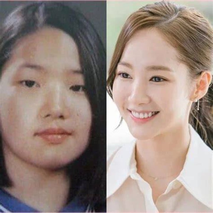 After Surgery Park Min-young