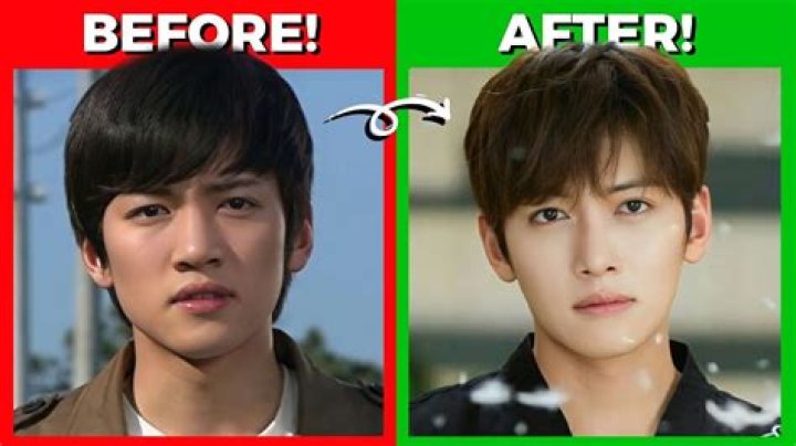 Korean Actor Plastic Surgery Before And After Photos