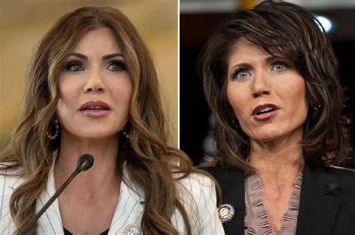 Kristi Noem Before Plastic Surgery / Kristi Noem Photos Of The South