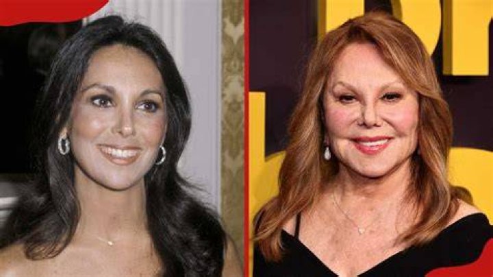 Marlo Thomas Plastic Surgery Diversity News Magazine